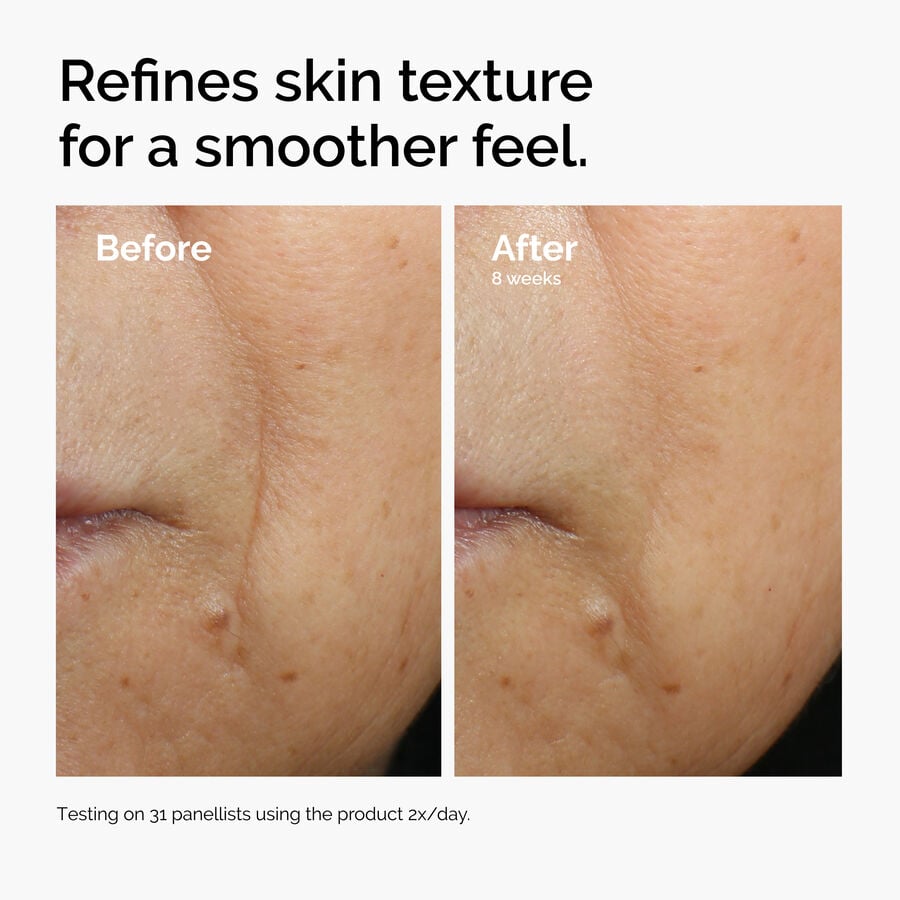 caffeine-3-escin-1-face-serum-p2 ord-caffeine-3pct-escin-1pct-face-serum-before-after-texture.jpg