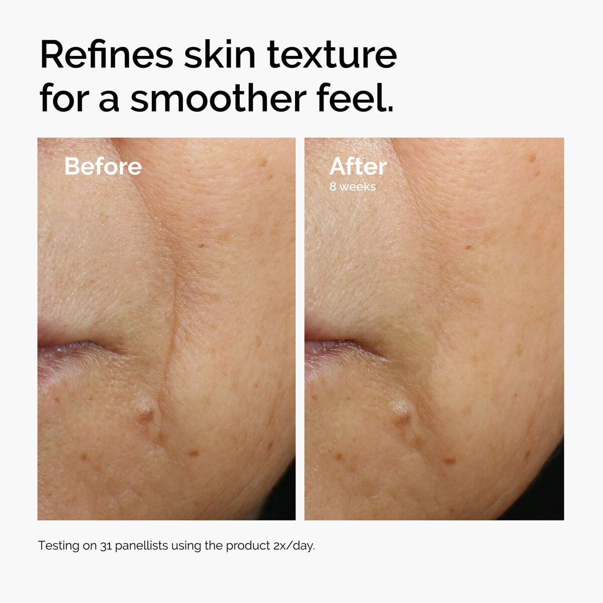caffeine-3-escin-1-face-serum-p2 ord-caffeine-3pct-escin-1pct-face-serum-before-after-texture.jpg