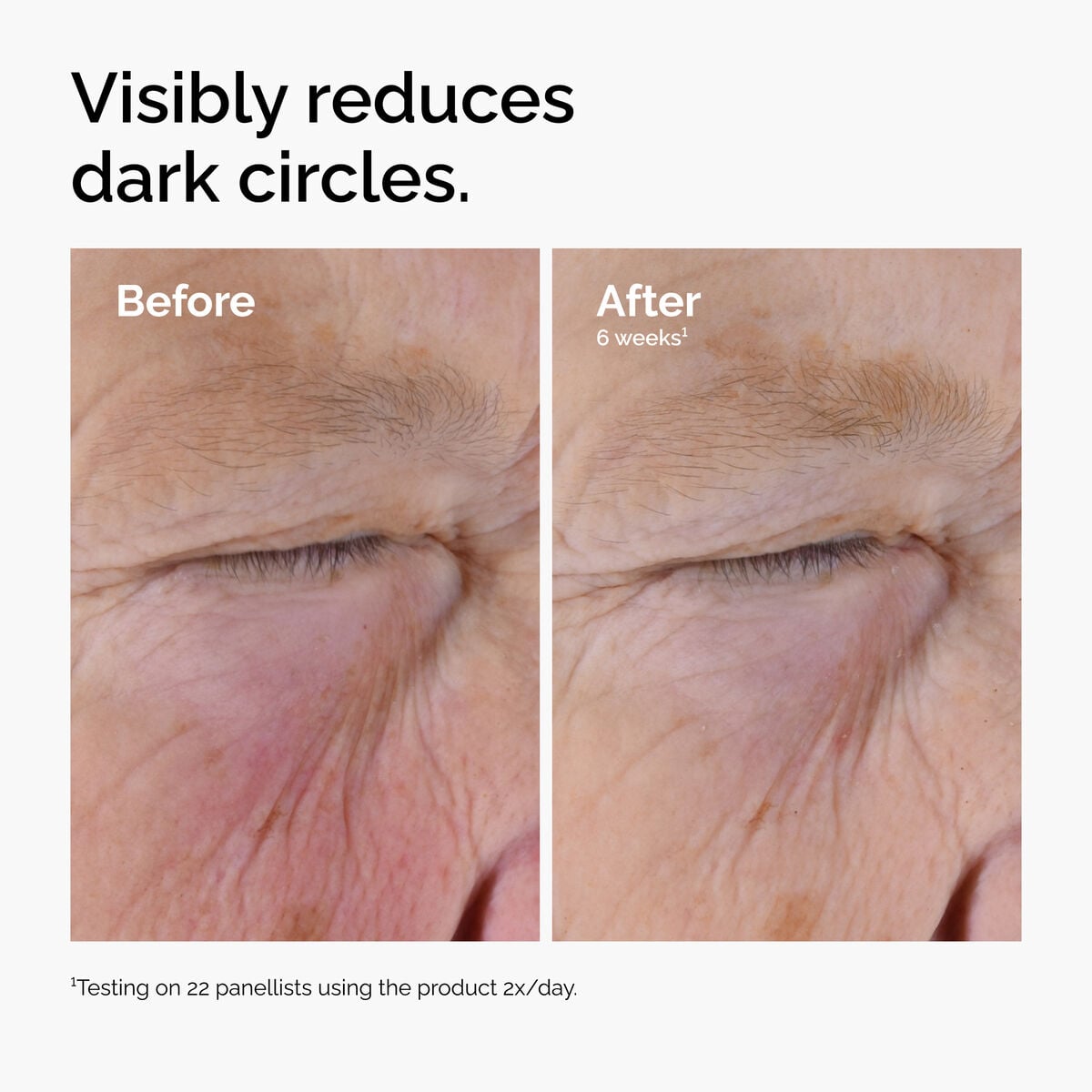caffeine-solution-5-egcg-eye-serum-m6 ord-caffeine-solution-egcg-dark-circles-before-after.jpg