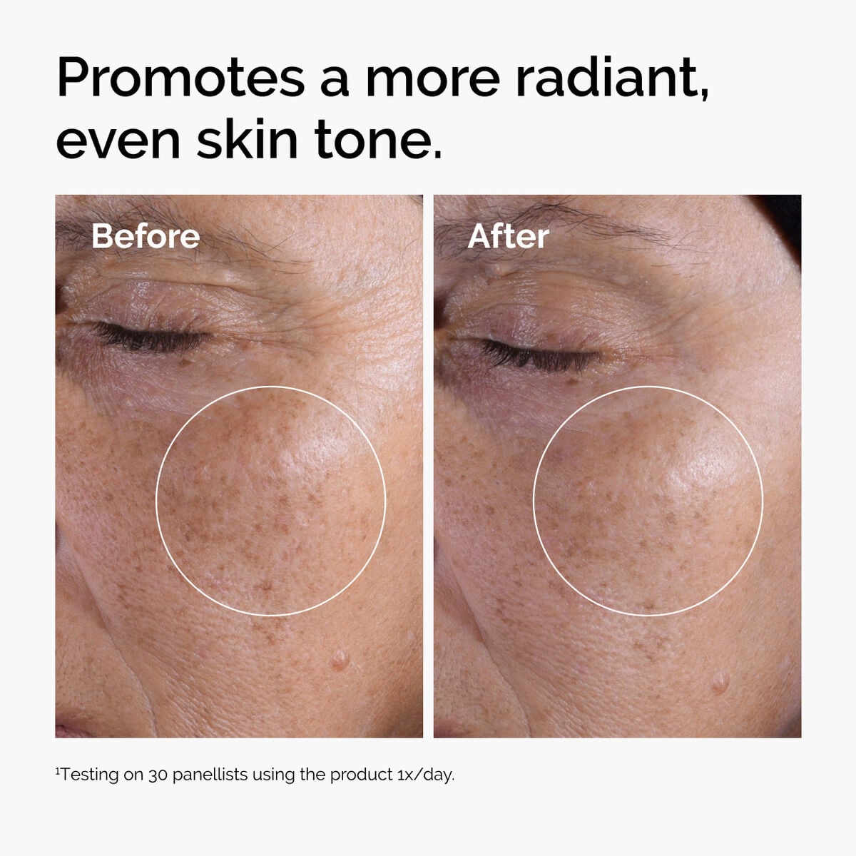 glycolic-acid-7-exfoliating-toner-g0 ord-glycolic-before-after-radiance.jpg