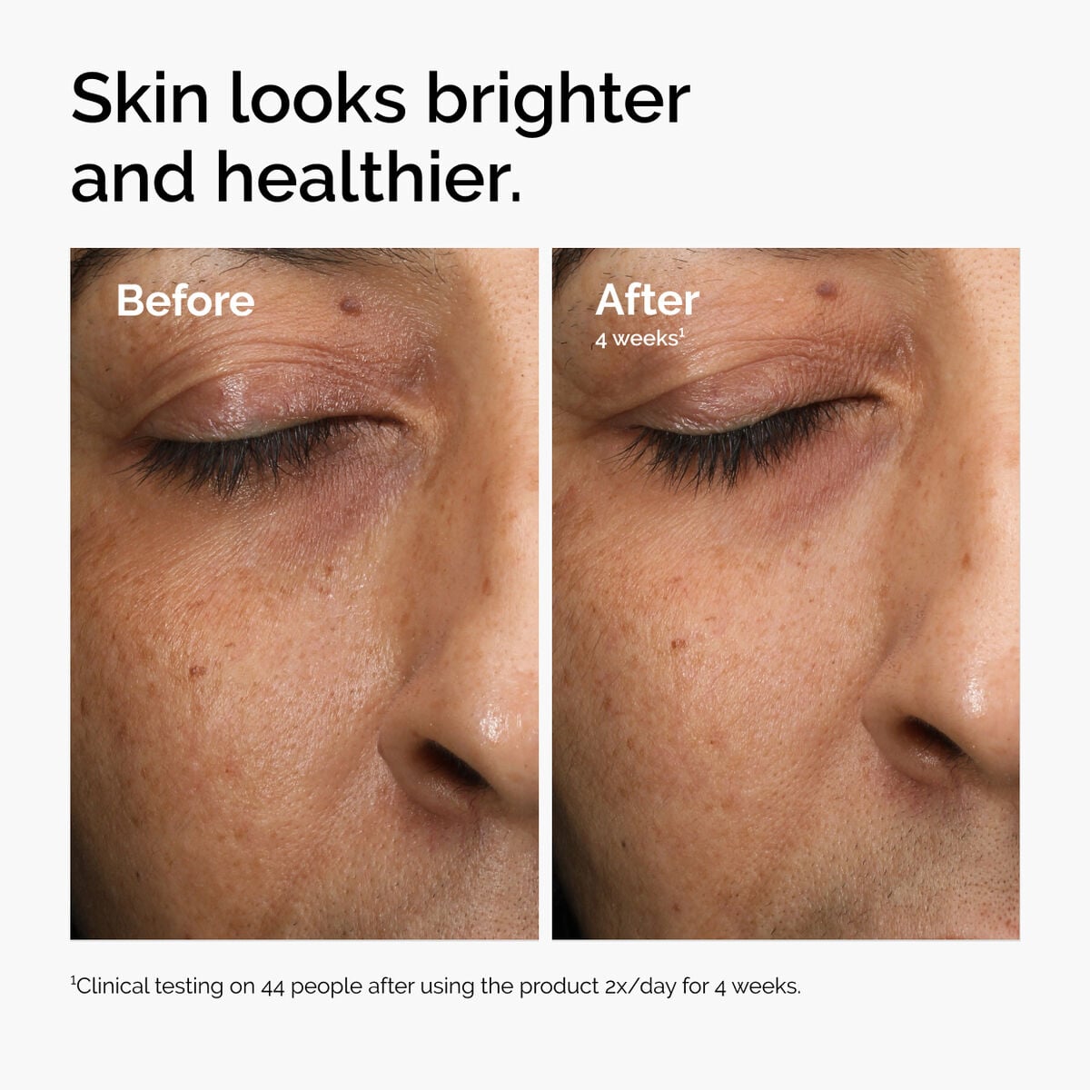 multi-antioxidant-radiance-serum-t7 ord-mars-before-after-healthy.jpg