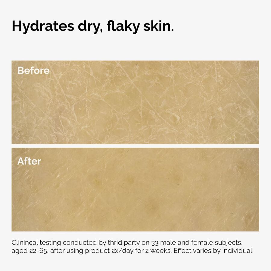 the-body-care-collection-o3 ord-natural-moisturizing-factors-inulin-body-before-after-graphic-02.jpg