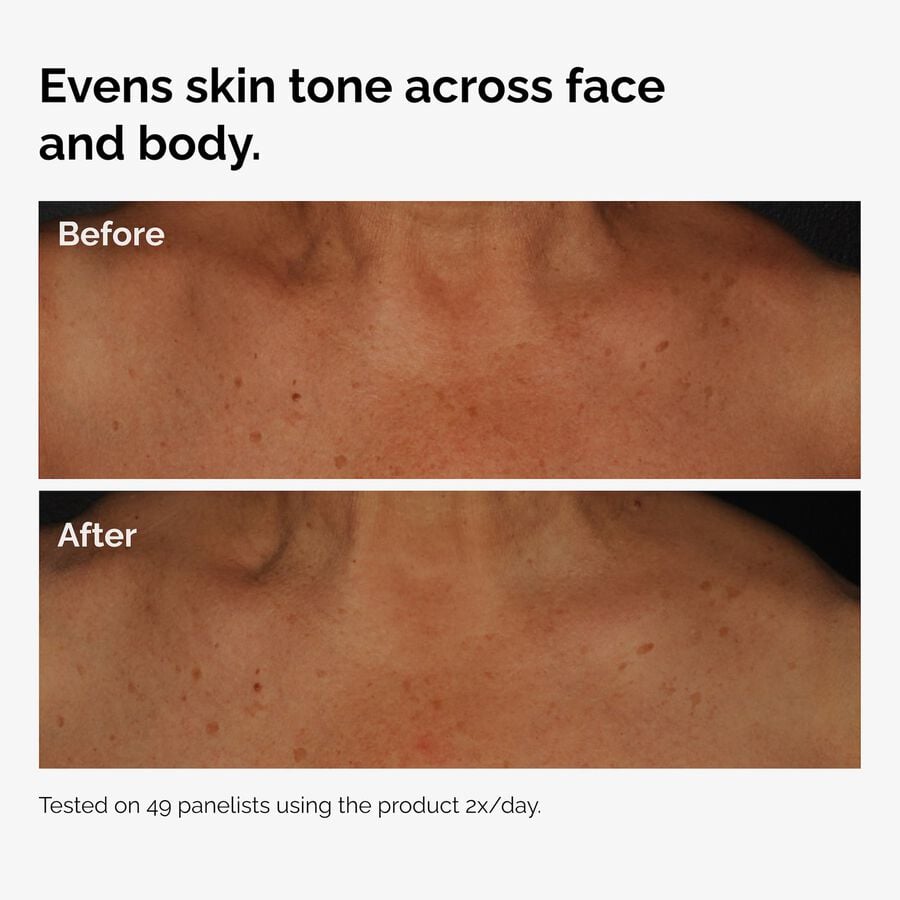 the-body-care-collection-o3 ord-niacinamide-face-body-serum-before-after-even-tone-graphic.jpg