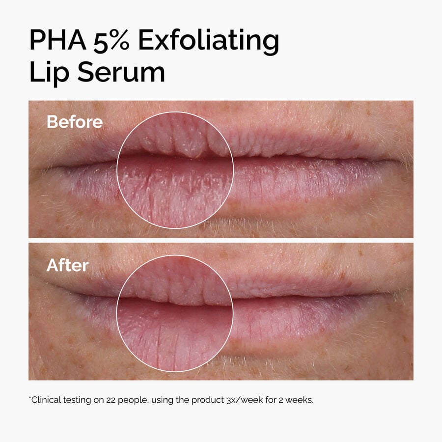 pha-5-exfoliating-lip-serum-f5 ord-pha-5pct-lip-exfoliating-serum-before-after.jpg